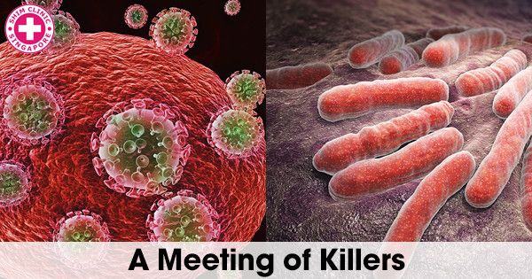 A Meeting of Young and Old Killers: AIDS and Tuberculosis