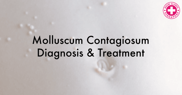 STD Testing: Molluscum Contagiosum