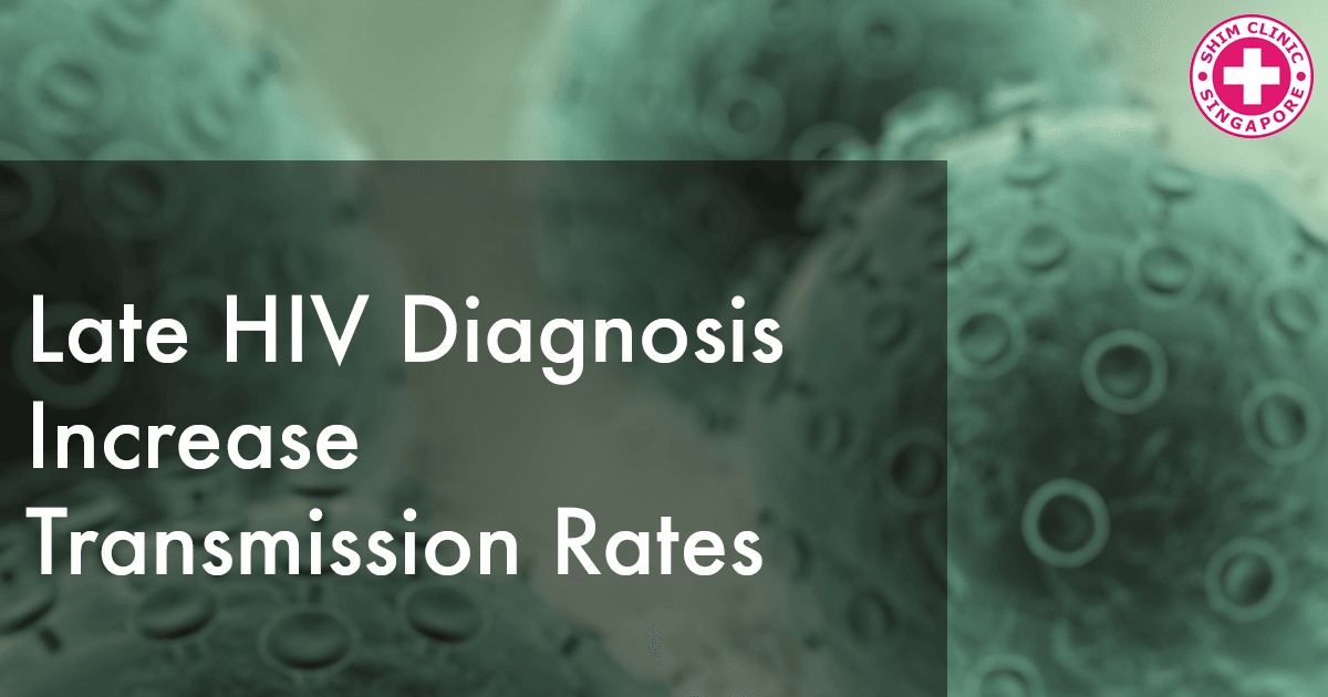 Late HIV Diagnosis Increase Transmission Rates
