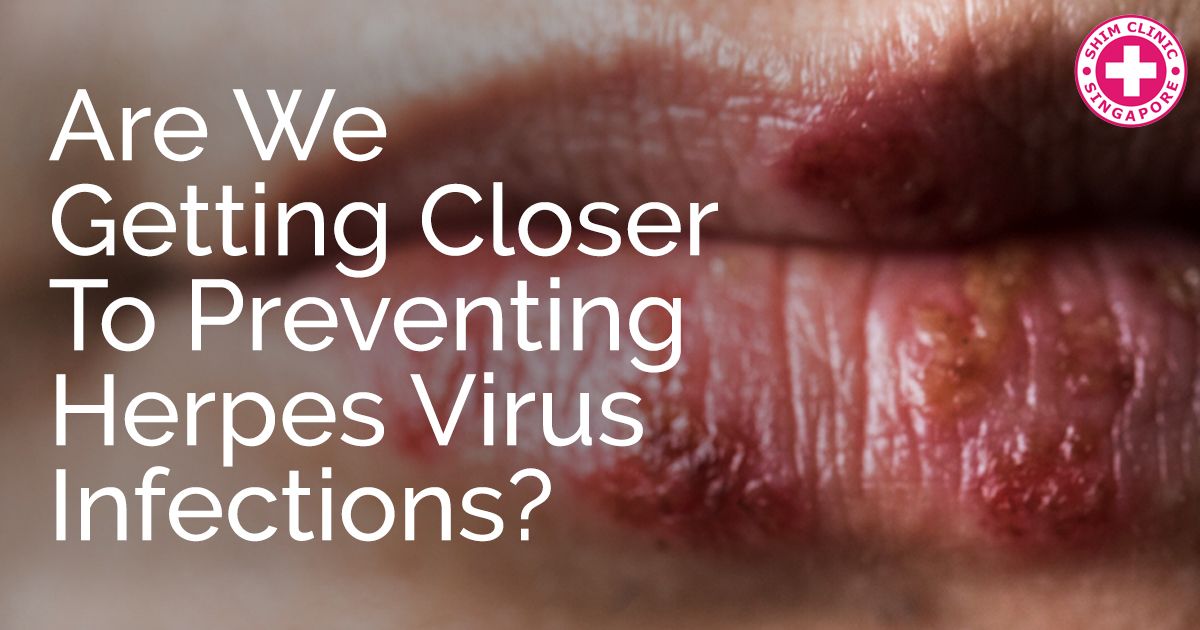 Are We Getting Closer to Preventing Herpes Virus Infections?