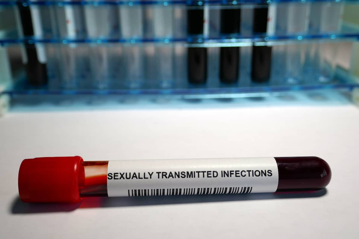 This Rare STD Can Go Undetected and Cause Serious (Fertility) Complications