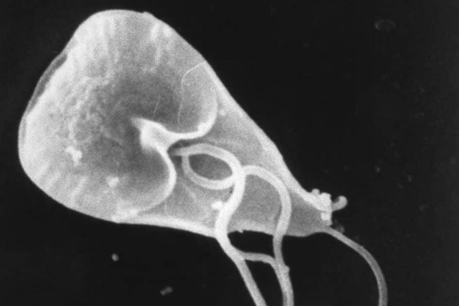 Giardiasis: What You Need To Know