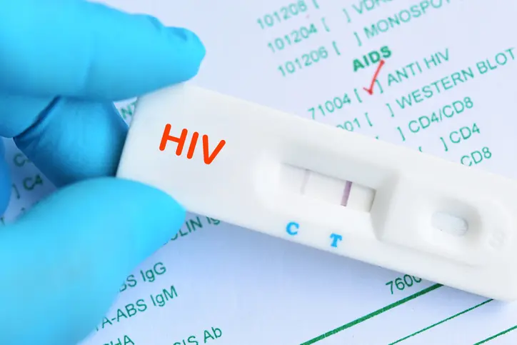 The Role of HIV Antigen Tests in Early Detection and Prevention