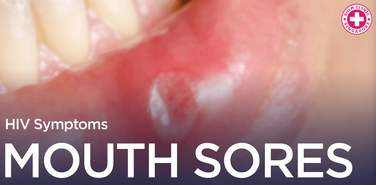 HIV Symptoms Mouth Sores Singapore